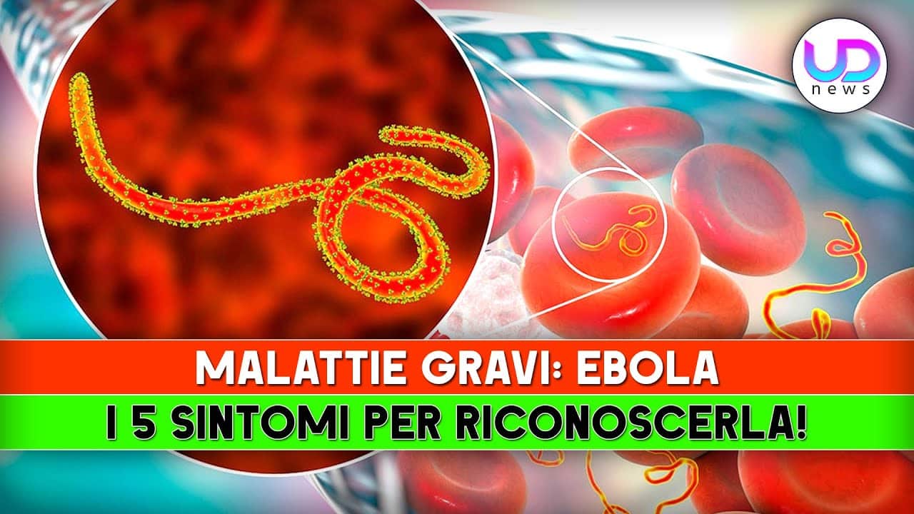 “5 Sintomi per Riconoscere l’Ebola: La Guida Completa di Cosmopolitan”